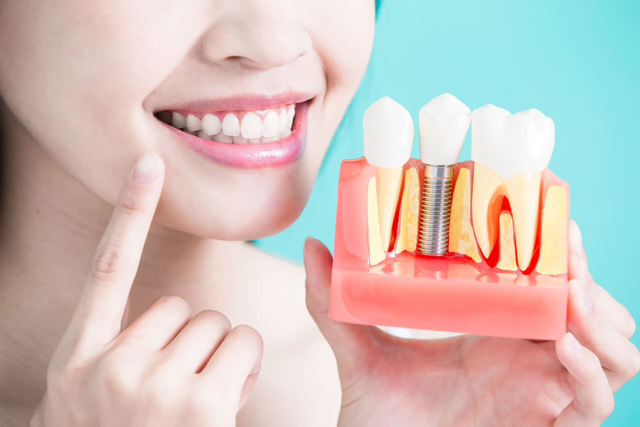 Dental implants offer a more permanent option over dentures