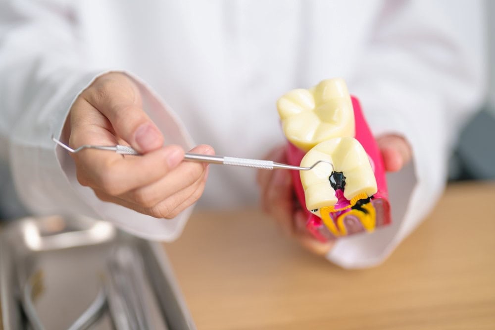 A dentist explaining about cavities and tooth decay